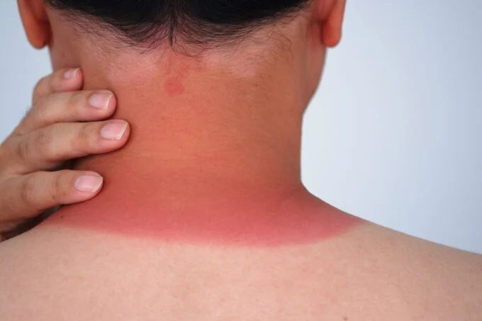 ¿Quemarte con el sol te ayuda a secar los granos?