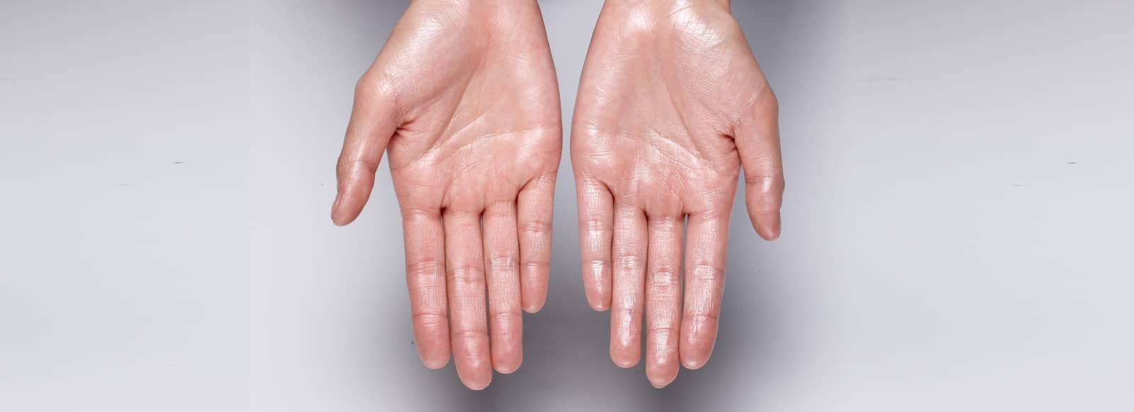 ¿Sudor excesivo? Esto es lo que un dermatólogo haría